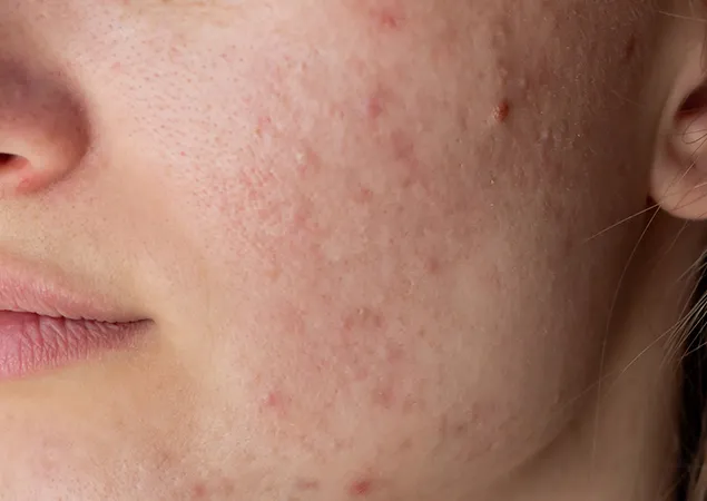 transformation-img-1