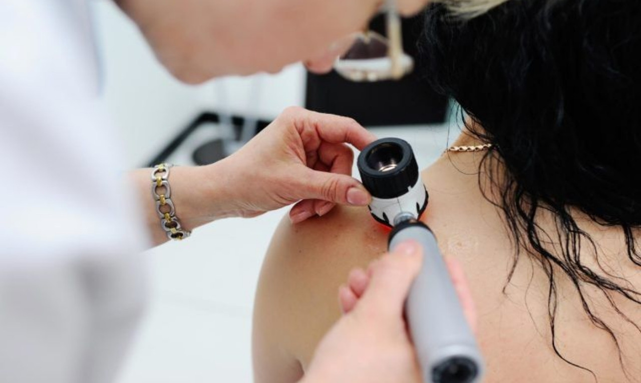 Skin checks and skin cancer treatment in Gympie