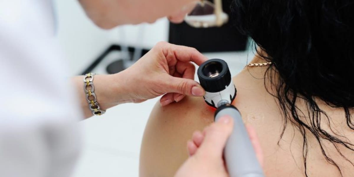 GP using a dermatoscope to check a mole on a patient's shoulder during a skin check